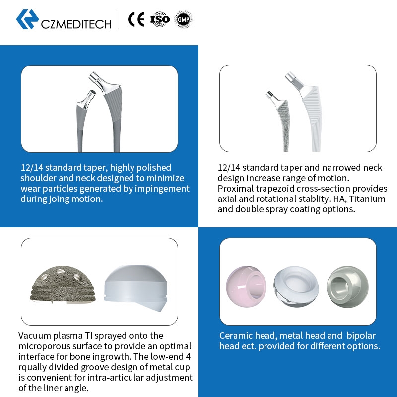 Hip and Knee Prosthetics