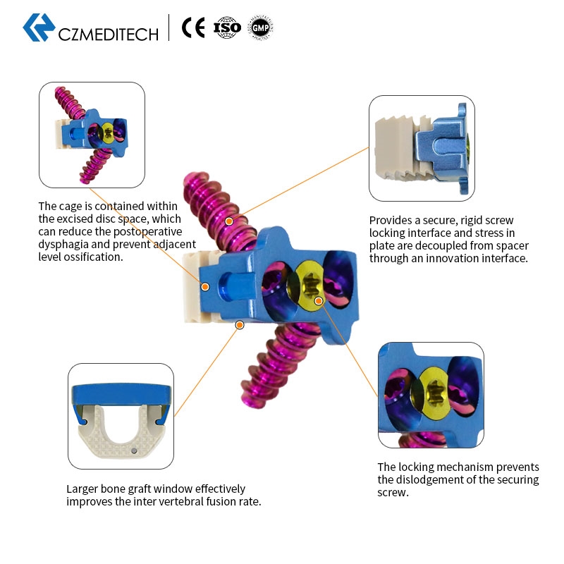 Cervical Peek Cage（2 or 4 Locking Screws）